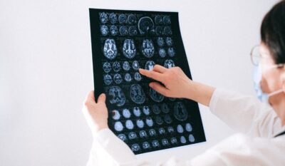 Paediatric Neurology