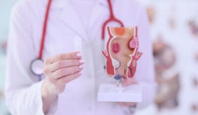 Haemorrhoid Banding
