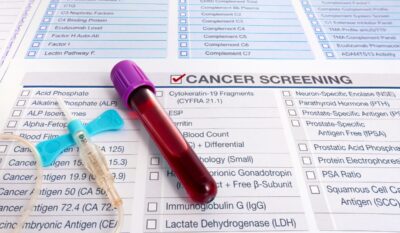 The Galleri®Test: its history, the NHS trial, and how to access it privately in the UK